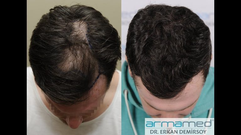 Armamed Clinic Review