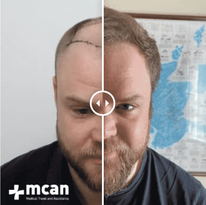 MCAN HEALTH review 1